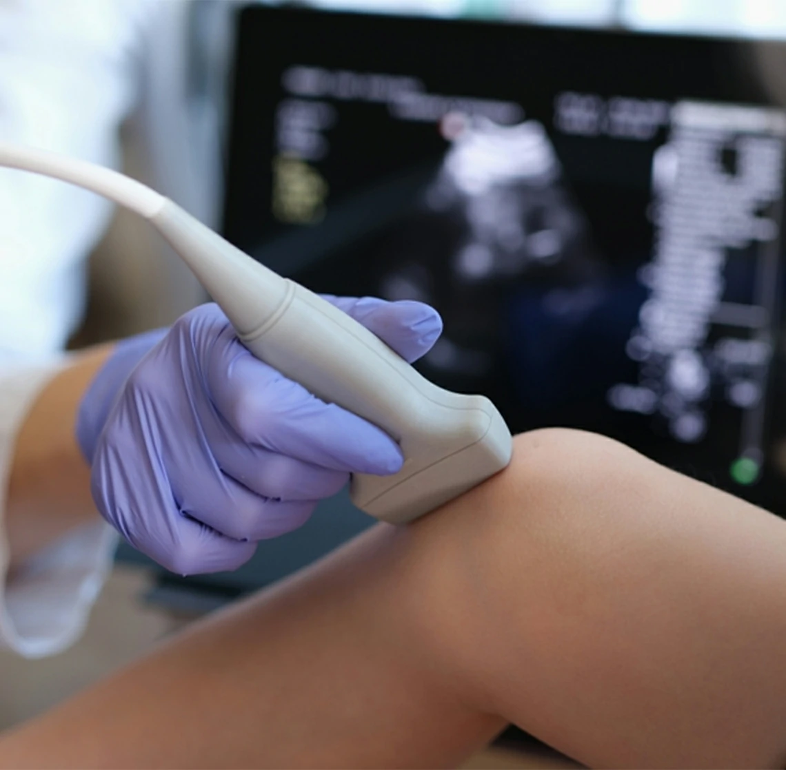 ultrasonido de rodilla