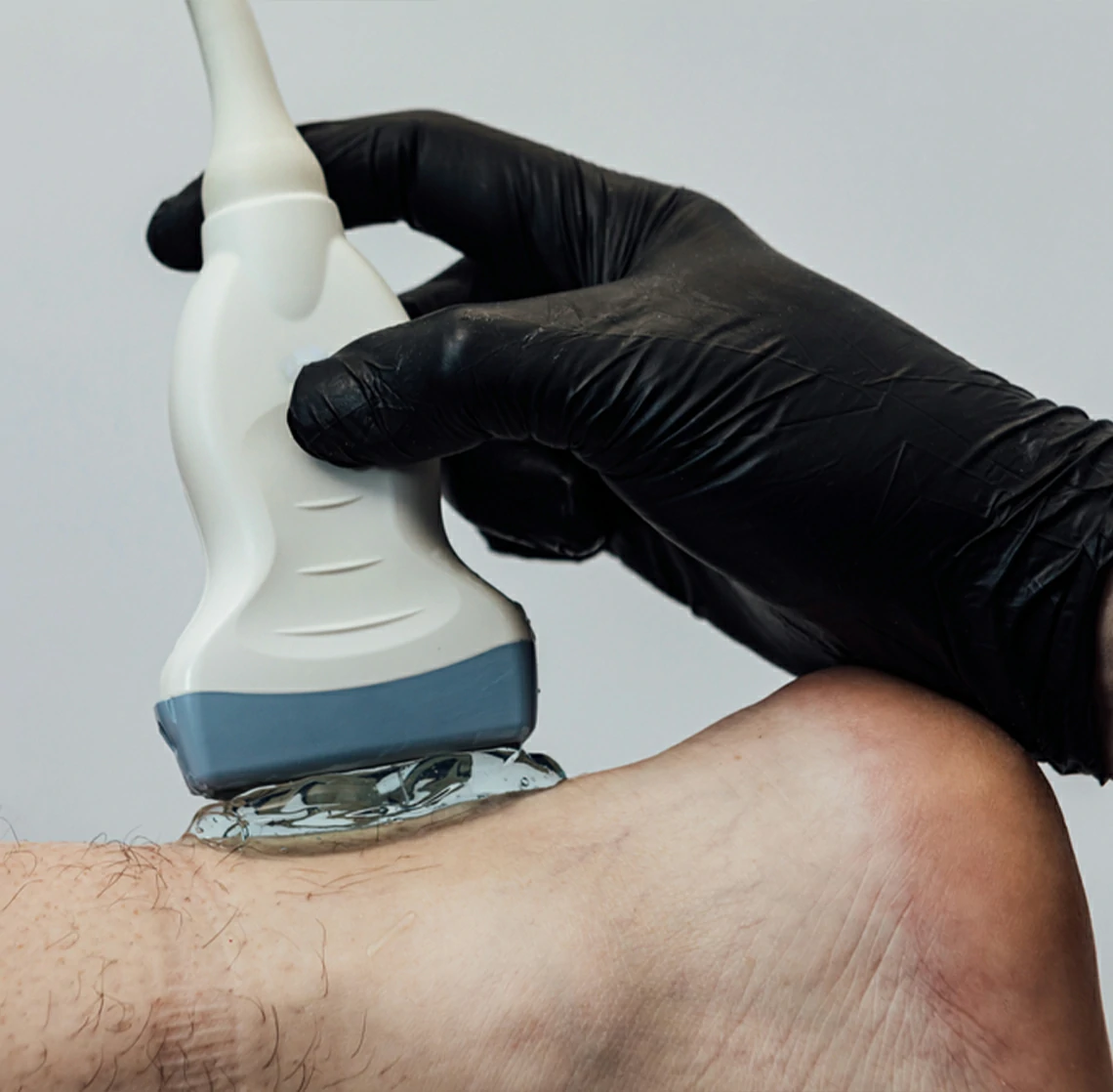 ultrasonido de tendon de aquiles