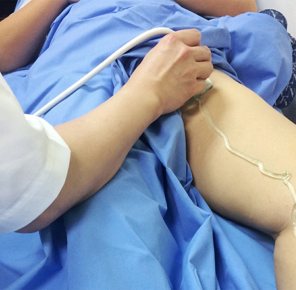 ultrasonido inguinal bilateral