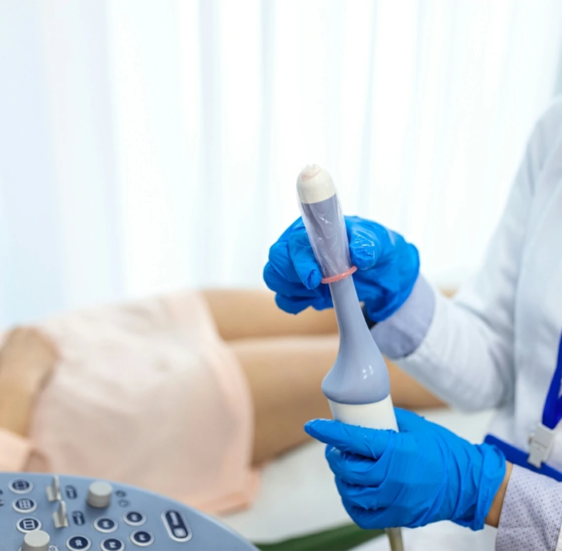 ultrasonido transvaginal con conteo folicular