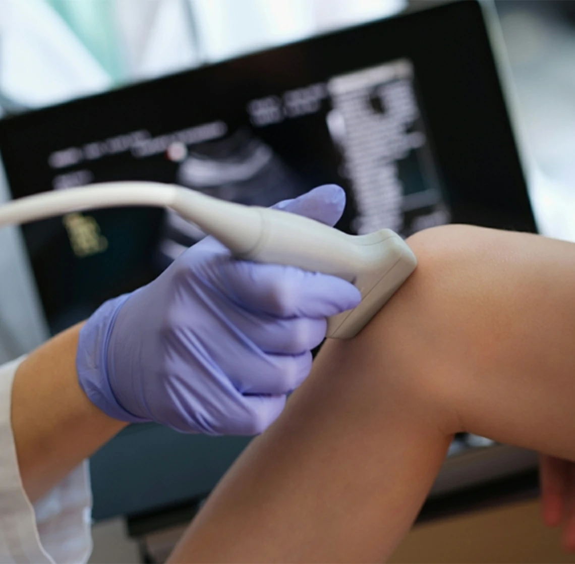 ultrasonido doppler arterial y venoso miembro pelvico pediatrico